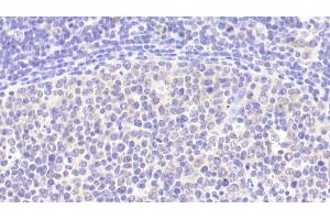 Detection of IL6 in Human Lymph node Tissue using Polyclonal Antibody to Interleukin 6 (IL6) (IL-6 anticorps  (AA 29-212))