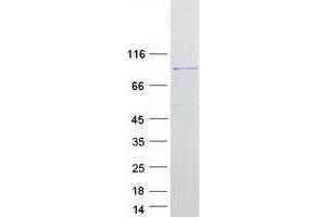 Validation with Western Blot