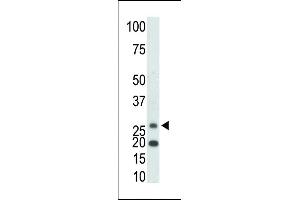 The anti-KHK Pab (ABIN391089 and ABIN2841230) is used in Western blot to detect KHK in mouse kidney tissue lysate.