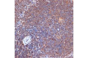 Immunohistochemistry of paraffin-embedded rat spleen using PI3 Kinase p110 delta Rabbit mAb (ABIN7269326) at dilution of 1:100 (40x lens). (PIK3CD anticorps)