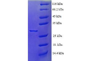 SDS-PAGE (SDS) image for Ribosomal Protein L35a (RPL35A) (AA 1-110), (full length) protein (His-SUMO Tag) (ABIN5710278)