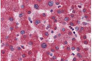 Human Liver: Formalin-Fixed, Paraffin-Embedded (FFPE)