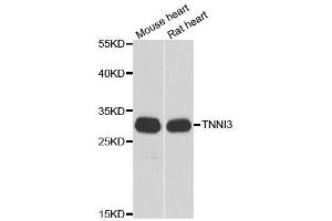 Western blot analysis of extracts of various cell lines, using TNNI3 antibody. (TNNI3 anticorps  (AA 1-210))