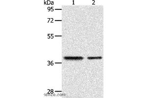 Western blot analysis of Human fetal kidney and fetal muscle tissue, using CNN3 Polyclonal Antibody at dilution of 1:400 (CNN3 anticorps)