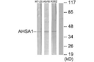 Western blot analysis of extracts from HT29 cells, A549 cells and K562 cells, using Collagen IX α2 antibody. (Collagen Type IX alpha 2 (COL9A2) (Internal Region) anticorps)