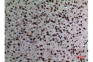 Immunohistochemistry (IHC) analysis of paraffin-embedded Mouse Brain, antibody was diluted at 1:100. (NR1H3 anticorps  (Internal Region))