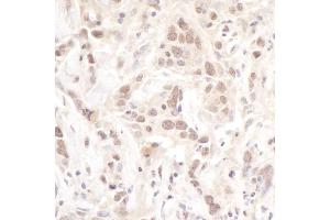 Immunohistochemistry (IHC) image for anti-Polymerase (DNA Directed), lambda (POLL) (AA 525-575) antibody (ABIN7454415) (POLL anticorps  (AA 525-575))