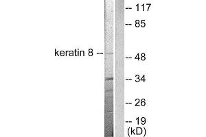 Western Blotting (WB) image for anti-Keratin 8 (KRT8) (C-Term) antibody (ABIN1848642) (KRT8 anticorps  (C-Term))