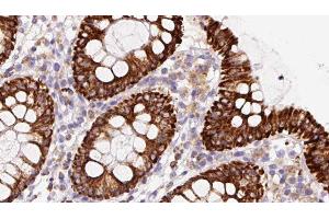 ABIN6279860 at 1/100 staining Mouse colon tissue by IHC-P. (STMN2 anticorps  (Internal Region))