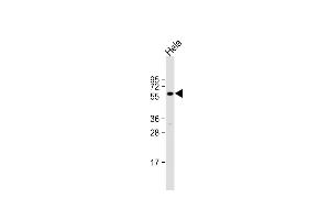 Anti-CYP2E1 Antibody (Center) at 1:2000 dilution + Hela whole cell lysate Lysates/proteins at 20 μg per lane.