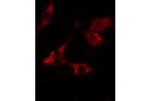 anti-Nedd4 Family Interacting Protein 1 (NDFIP1) (C-Term) antibody