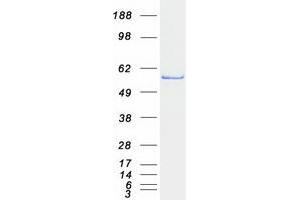 Validation with Western Blot