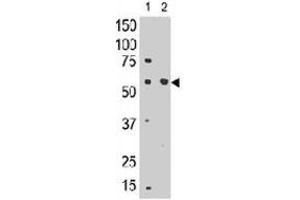 The SIGLEC8 polyclonal antibody  is used in Western blot to detect SIGLEC8 in mouse liver tissue lysate (lnae 1) and in HL-60 cell lysate (lane 2) . (SIGLEC8 anticorps  (C-Term))