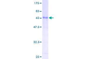 Image no. 1 for Activating Transcription Factor 1 (AFT1) (AA 1-271) protein (GST tag) (ABIN1345919)
