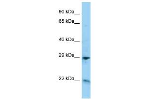 WB Suggested Anti-ADM Antibody Titration: 1. (Adrenomedullin anticorps  (C-Term))