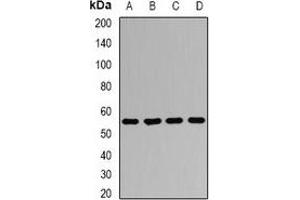 Western blot analysis of AGFG1 expression in Jurkat (A), HepG2 (B), mouse lung (C), mouse testis (D) whole cell lysates. (AGFG1 anticorps)