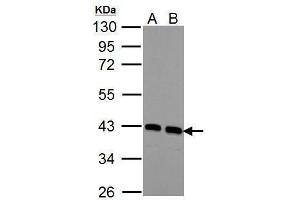 WB Image Sample (30 ug of whole cell lysate) A: NIH-3T3 B: JC 10% SDS PAGE antibody diluted at 1:1000 (CNN3 anticorps)