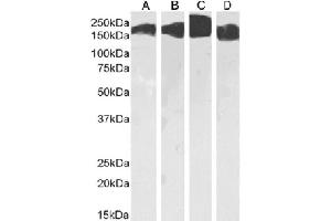 Western Blot using anti-CD171 antibody L1-14. (Recombinant L1CAM anticorps)