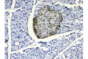 IHC analysis of COPE using anti-COPE antibody . (COPE anticorps  (AA 80-308))