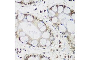 Immunohistochemistry of paraffin-embedded human gastric using CBX3 antibody.