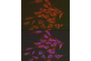 Immunofluorescence analysis of NIH/3T3 cells using Sorbitol Dehydrogenase Rabbit pAb (ABIN3022961, ABIN3022962, ABIN3022963, ABIN1513552 and ABIN6219319) at dilution of 1:50 (40x lens).