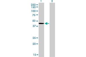 Western Blot analysis of TXNDC4 expression in transfected 293T cell line by TXNDC4 monoclonal antibody (M01A), clone 3C7. (ERP44 anticorps  (AA 30-406))