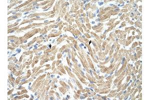 Tropomyosin 1 antibody was used for immunohistochemistry at a concentration of 4-8 ug/ml to stain Skeletal muscle cells (arrows) in Human Muscle. (Tropomyosin anticorps)