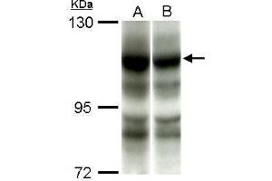 WB Image Sample (50 ug of whole cell lysate) A: C2C12 B: C2C12+AEA10mM antibody diluted at 1:1000 (PIK3CA anticorps  (N-Term))
