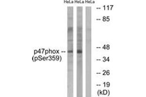 Western blot analysis of extracts from HeLa cells treated with nocodazole 1ug/ml 18h, using p47 phox (Phospho-Ser359) Antibody. (NCF1 anticorps  (pSer359))