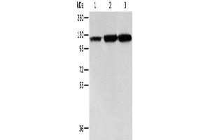 Western Blotting (WB) image for anti-Heat Shock 105kDa/110kDa Protein 1 (HSPH1) antibody (ABIN2421692) (HSPH1 anticorps)