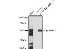 Immunoprecipitation analysis of 200 μg extracts of 293T cells, using 3 μg Phospho-p53-S15 pAb (ABIN3023600, ABIN3023601, ABIN3023602 and ABIN6225458). (p53 anticorps  (pSer15))