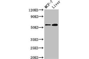 Western Blot Positive WB detected in: MCF-7 whole cell lysate, Mouse liver tissue All lanes: CBS antibody at 2. (CBS anticorps  (AA 1-413))