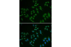 Immunofluorescence analysis of U2OS cells using TP63 antibody (ABIN5971164). (p63 anticorps)
