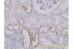 Immunoperoxidase of monoclonal antibody to SLC25A11 on formalin-fixed paraffin-embedded human kidney.