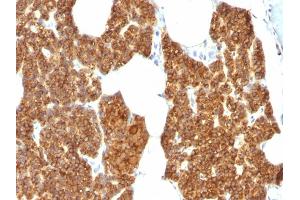 Formalin-fixed, paraffin-embedded human Parathyroid Gland stained with PTH Rabbit Polyclonal Antibody. (PTH anticorps  (AA 1-115))