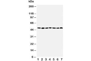 Western blot testing of CtBP1 antibody and Lane 1:  rat brain