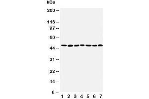 Western blot testing of CtBP1 antibody and Lane 1:  rat brain (CTBP1 anticorps  (AA 425-440))