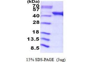 AckA (AA 1-400) protein (His tag)