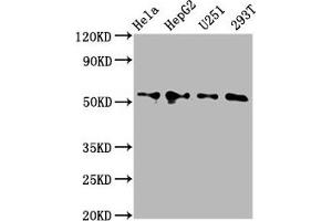 Western Blot Positive WB detected in: Hela whole cell lysate, HepG2 whole cell lysate, U251 whole cell lysate, 293T whole cell lysate All lanes: CCT6A antibody at 4. (CCT6A anticorps  (AA 80-250))