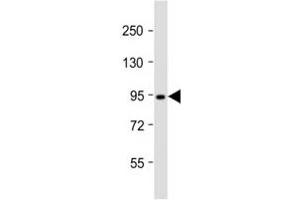 Western blot testing of Dnmt3b antibody at 1:2000 dilution + T47D lysate