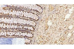 Immunohistochemistry of paraffin-embedded Human colon tissue using CDX2 Monoclonal Antibody at dilution of 1:200. (CDX2 anticorps)
