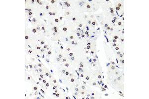 Immunohistochemistry of paraffin-embedded human stomach using HIST1H2BG antibody (ABIN6003628) at dilution of 1/100 (40x lens). (HIST1H2BG anticorps)