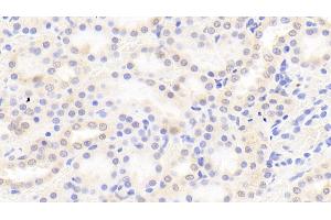 Detection of F2 in Rat Kidney Tissue using Polyclonal Antibody to Coagulation Factor II (F2)