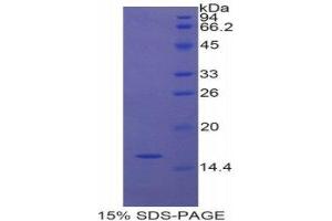 SDS-PAGE (SDS) image for Nitric Oxide Synthase 1, Neuronal (NOS1) (AA 9-136) protein (His tag) (ABIN1525537) (NOS1 Protein (AA 9-136) (His tag))