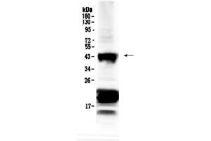 Western blot analysis of CHX10 using anti-CHX10 antibody . (VSX2 anticorps  (AA 249-361))