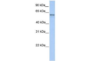 WB Suggested Anti-FAM13C1 Antibody Titration: 0. (FAM13C anticorps  (N-Term))