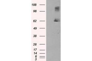 HEK293T cells were transfected with the pCMV6-ENTRY control (Left lane) or pCMV6-ENTRY LIPG (Right lane) cDNA for 48 hrs and lysed. (LIPG anticorps)