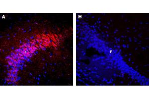 Expression of nAChRα7 in mouse hippocampusImmunohistochemical staining of perfusion-fixed frozen mouse brain sections with Guinea Pig Anti-Nicotinic Acetylcholine Receptor α7 (CHRNA7) (extracellular) Antibody (ABIN7581857), (1:300), followed by goat anti-guinea pig-Alexa-594. (Cholinergic Receptor, Nicotinic, alpha 7 (Neuronal) (CHRNA7) Peptide)