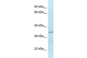 WB Suggested Anti-Sult1c2 Antibody Titration: 1. (SULT1C2 anticorps  (Middle Region))
