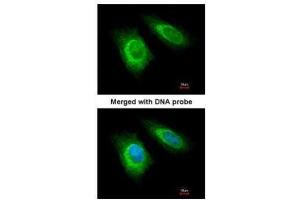 ICC/IF Image Immunofluorescence analysis of paraformaldehyde-fixed HeLa, using ZNHIT1, antibody at 1:100 dilution.